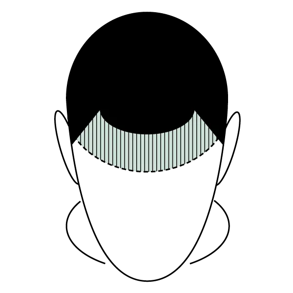 micro scalp